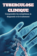 Tuberculose Clinique: Comprendre les symptmes, le diagnostic et le traitement