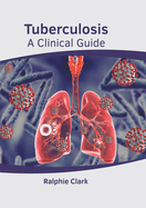 Tuberculosis: A Clinical Guide