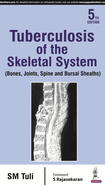 Tuberculosis of the Skeletal System