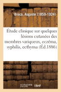 ?tude Clinique Sur Quelques L?sions Cutan?es Des Membres Variqueux, Ecz?ma, Syphilis, Ecthyma