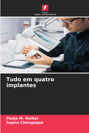 Tudo em quatro implantes