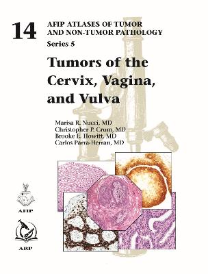 Tumors of the Cervix, Vagina, and Vulva - Nucci, Marisa R., and Crum, Christopher P., and Howitt, Brooke E.
