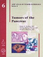 Tumors of the Pancreas