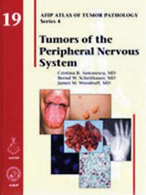 Tumors of the Peripheral Nervous System - Antonescu, Cristina R., and Scheithauer, Bernd W., and Woodruff, James M.