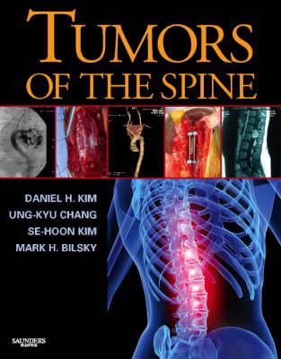 Tumors of the Spine - Kim, Daniel H, and Chang, Ung-Kyu, MD, PhD, and Kim, Se-Hoon, MD, PhD