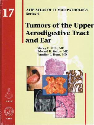 Tumors of the Upper Aerodigestive Tract and Ear - Mills, Stacey E., and Stelow, Edward B., and Hunt, Jennifer L.