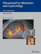 Ultrasound in Obstetrics and Gynecology: Volume 2: Gynecology