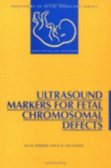 Ultrasound Markers for Fetal Chromosomal Defects - Nicolaides, K H (Editor), and Snijders, R J M (Editor)