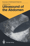 Ultrasound of the Abdomen: 114 Radiological Exercises for Students and Practitioners