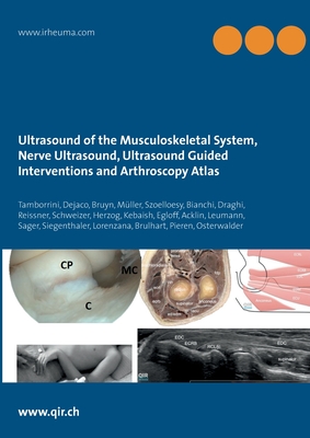 Ultrasound of the Musculoskeletal System, Nerve Ultrasound, Ultrasound Guided Interventions and Arthroscopy Atlas: Musculoskeletal Sonoanatomy Guidelines - Tamborrini, Giorgio, and George a W Bruyn, Christian Dejaco, and Andreas Schweizer, Lisa Reissner