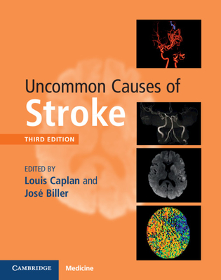 Uncommon Causes of Stroke - Caplan, Louis (Editor), and Biller, Jos (Editor)