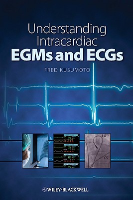 Understanding Intracardiac EGMs and ECGs - Kusumoto, Fred M