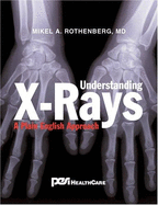 Understanding X-Rays: A Plain English Approach