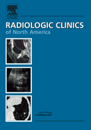 Upper Extremity, an Issue of Radiologic Clinics: Volume 44-4 - Beltran, Javier, and Zanetti, and Hodler