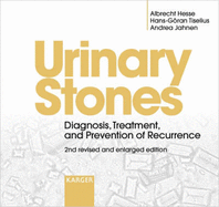 Urinary Stones: Diagnosis, Treatment, and Prevention of Recurrence