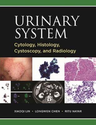 Urinary System: Cytology, Histology, Cystoscopy, and Radiology - Lin, Xiaoqi (Editor), and Chen, Longwen (Editor), and Nayar, Ritu (Editor)