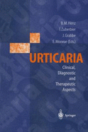 Urticaria: Clinical, Diagnostic and Therapeutic Aspects