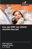 Uso del PRP nei difetti maxillo-facciali