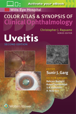 Uveitis - Garg, Sunir J