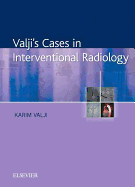 Valji's Cases in Interventional Radiology Access Code