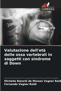 Valutazione dell'et? delle ossa vertebrali in soggetti con sindrome di Down