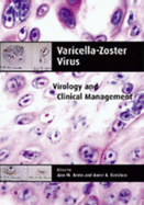 Varicella-Zoster Virus: Virology and Clinical Management