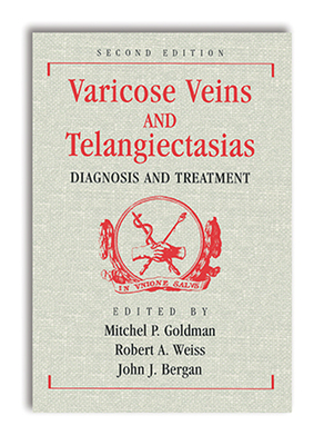 Varicose Veins and Telangiectasias: Diagnosis and Treatment, Second Edition - Goldman, Mitchel (Editor), and Weiss, Robert (Editor), and Bergan, John (Editor)