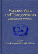 Varicose Veins and Telangiectasias