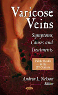 Varicose Veins: Symptoms, Causes & Treatments