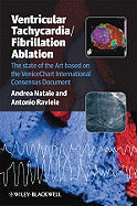 Ventricular Tachycardia / Fibrillation Ablation: The State of the Art Based on the Venicechart International Consensus Document