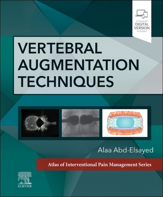 Vertebral Augmentation Techniques - Abd-Elsayed, Alaa, MD, MPH (Editor)