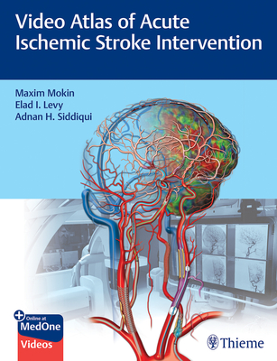 Video Atlas of Acute Ischemic Stroke Intervention - Mokin, Maxim, and Levy, Elad, and Siddiqui, Adnan