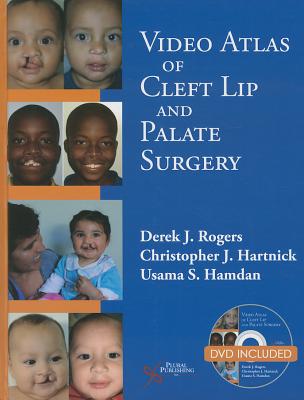 Video Atlas of Cleft Lip and Palate Surgery - Rogers, Derek (Editor), and Hartnick, Christopher J. (Editor), and Hamdan, Usama (Editor)