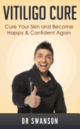 Vitiligo Cure: Cure your Skin and Become Happy & Confident Again