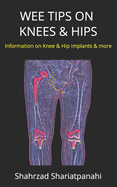 Wee Tips on Knees & Hips: Information on Knee & Hip Implants and More