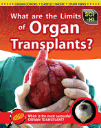 What Are the Limits of Organ Transplantation?