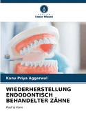 Wiederherstellung Endodontisch Behandelter Z?hne