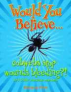 Would You Believe...cobwebs stop wounds bleeding?: and other medical marvels