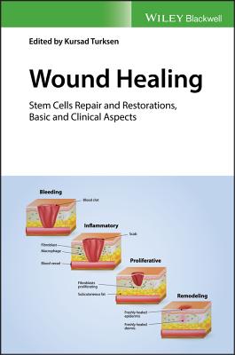 Wound Healing: Stem Cells Repair and Restorations, Basic and Clinical Aspects - Turksen, Kursad (Editor)