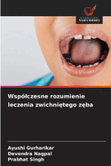 Wsp?lczesne rozumienie leczenia zwichni tego z ba