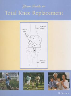 Your Guide to Total Knee Replacement - Fairview Health Services (Creator)