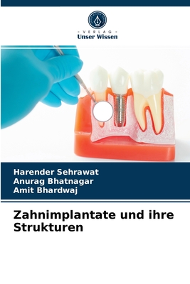 Zahnimplantate und ihre Strukturen - Sehrawat, Harender, and Bhatnagar, Anurag, and Bhardwaj, Amit